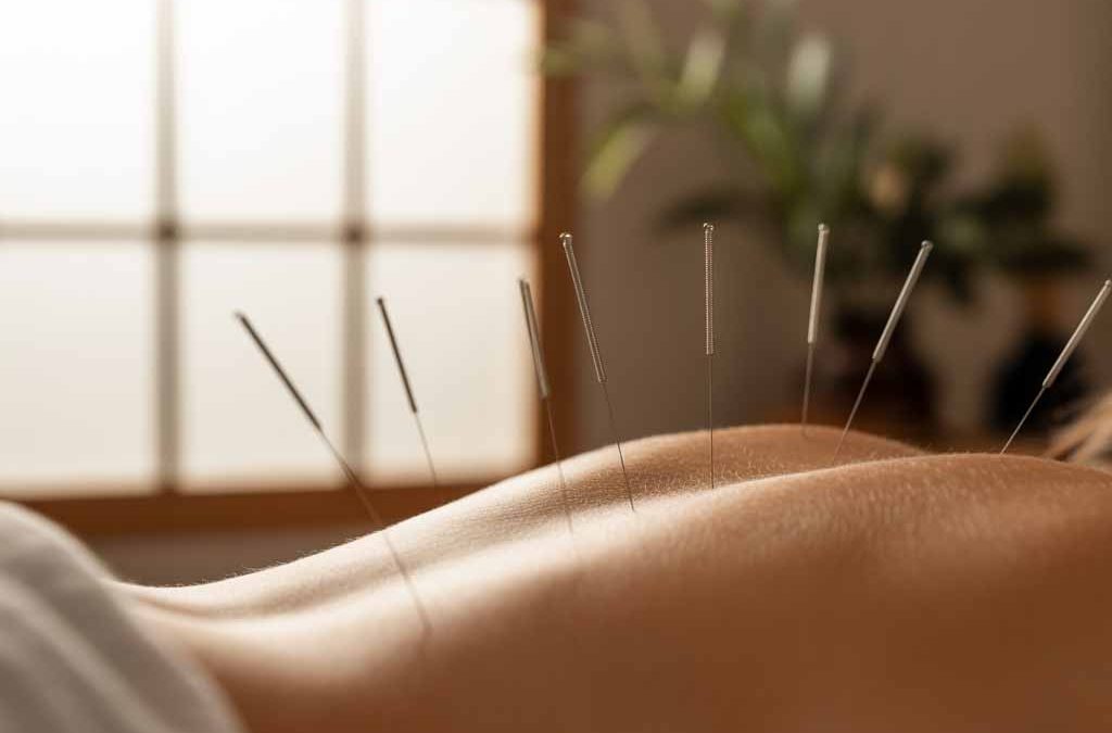 The Healing Power of Acupuncture at Boca Health & Wellness Center