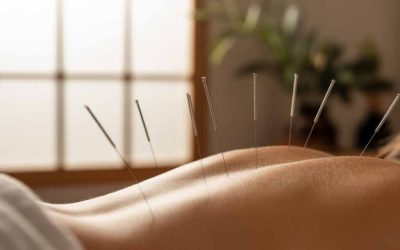 The Healing Power of Acupuncture at Boca Health & Wellness Center